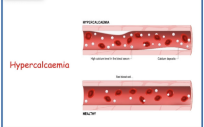 Unveiling the Silent Threat: Subclinical Calcium Dysregulation Syndrome (sCDS)